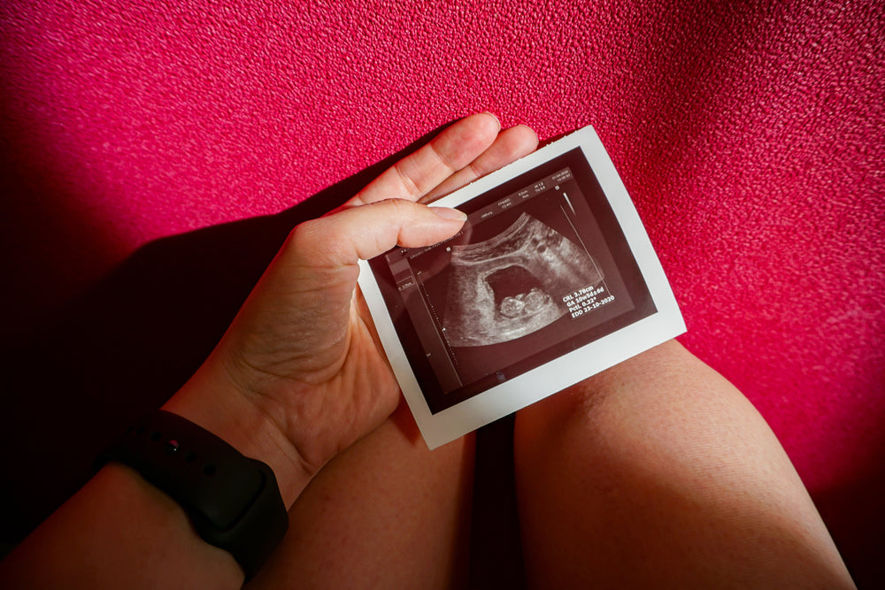 Miscarriages and Postpartum Depression